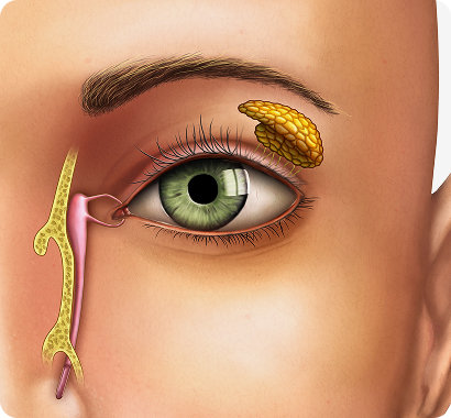 Nasolacrimal Duct Obstructions