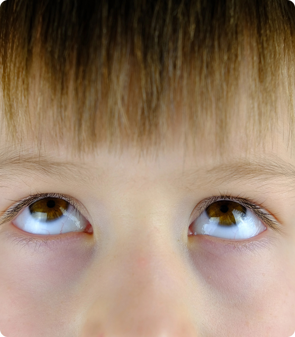 Understanding Genetic Eye Disease in Children