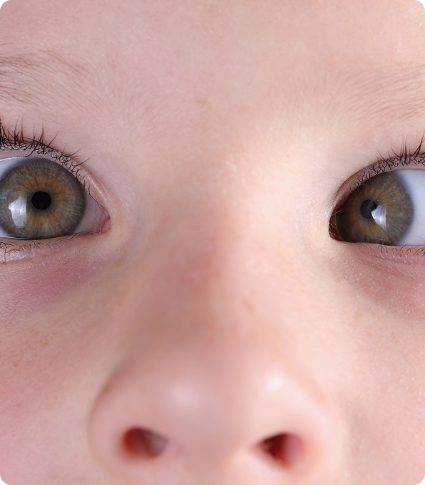 Understanding Strabismus in Children